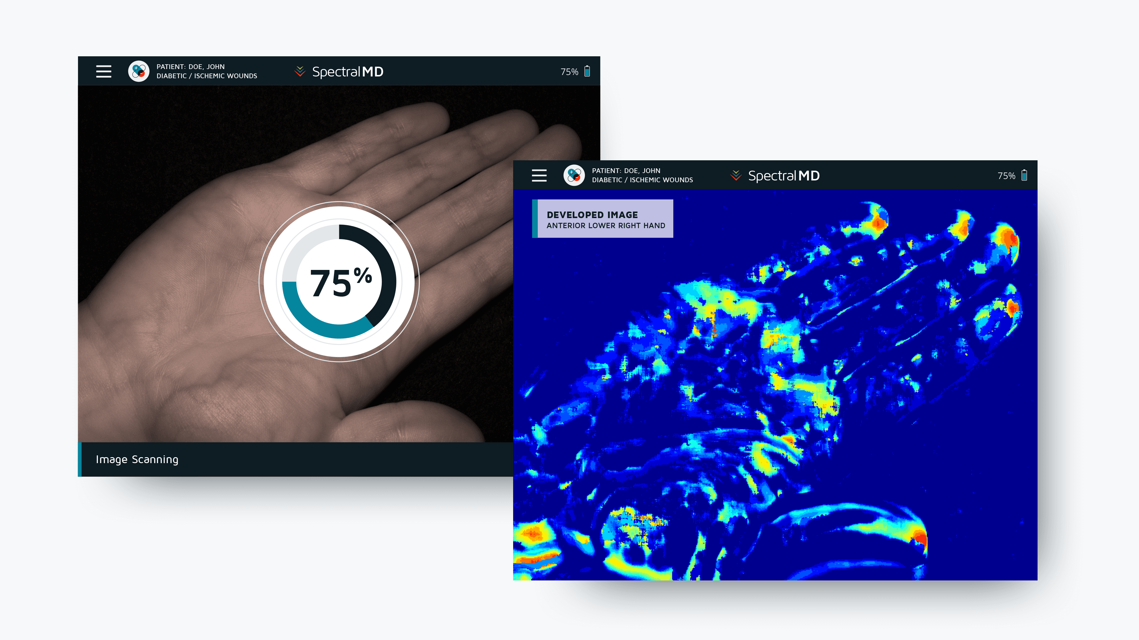 Two DeepView touchscreen interface mockups showing imaging and analysis states.